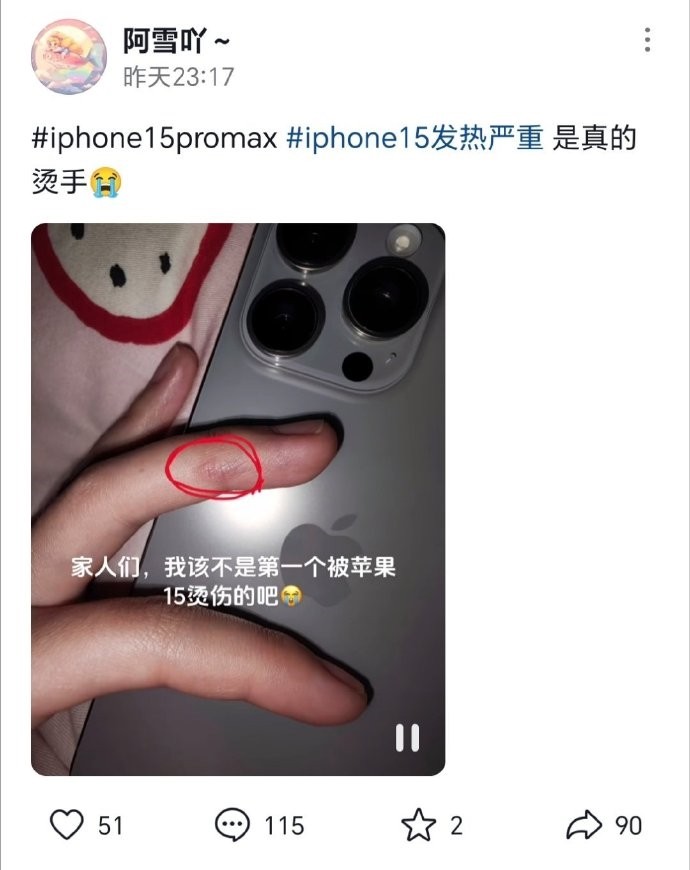 iPhone 15被投诉发热严重 竟有用户大腿被烫伤